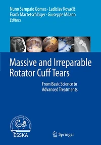 Massive and Irreparable Rotator Cuff Tears: From Basic Science to Advanced Treatments