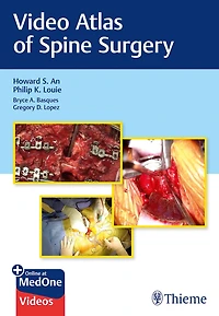 Video Atlas Of Spine Surgery