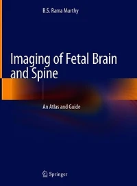 Imaging Of Fetal Brain And Spine: An Atlas Guide