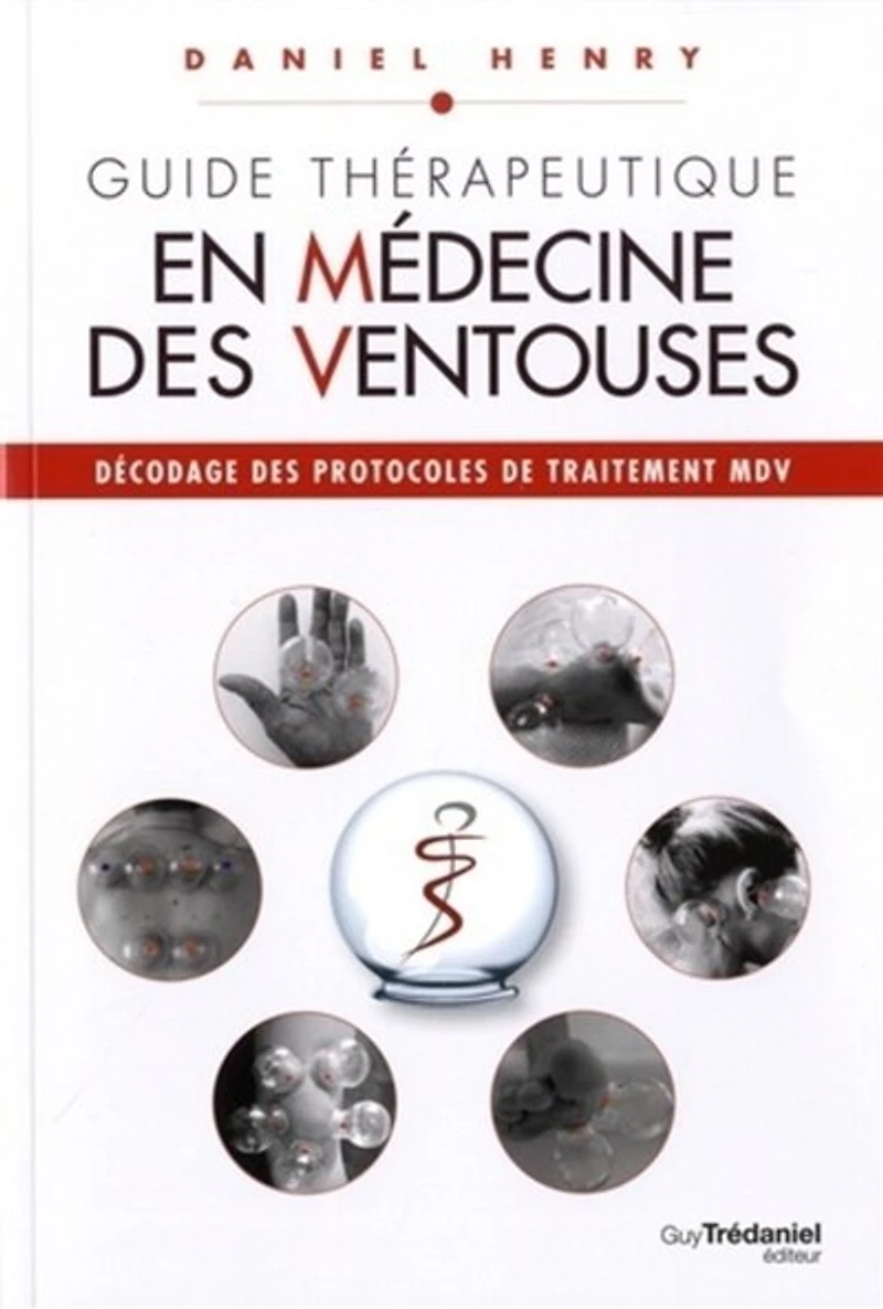 Décodage des protocoles de traitement MDV