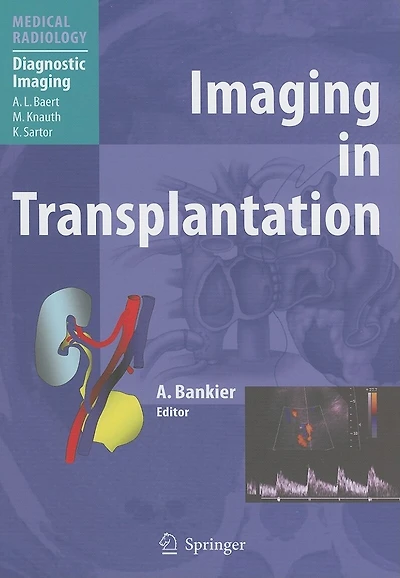Imaging Transplantation