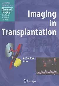 Imaging Transplantation