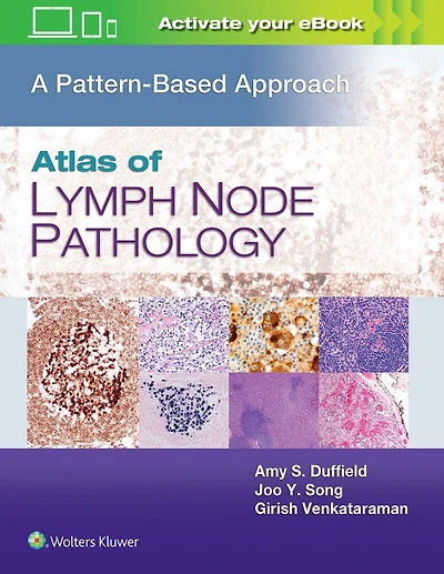 Atlas of Lymph Node Pathology: A Pattern Based Approach