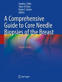 A Comprehensive Guide to Core Needle Biopsies of the Breast