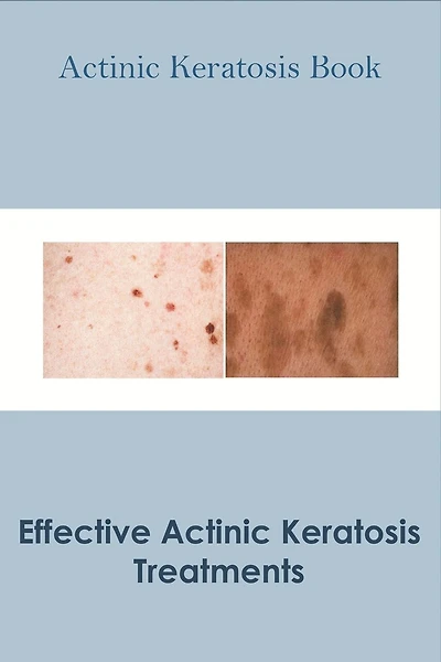Actinic Keratosis Book_ Effective Actinic Keratosis Treatments: Actinic Keratosis Disease Book
