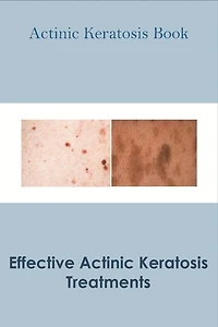 Actinic Keratosis Book_ Effective Actinic Keratosis Treatments: Actinic Keratosis Disease Book
