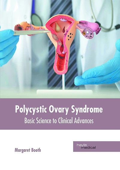 Polycystic Ovary Syndrome: Basic Science to Clinical Advances