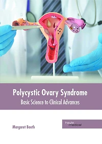 Polycystic Ovary Syndrome: Basic Science to Clinical Advances