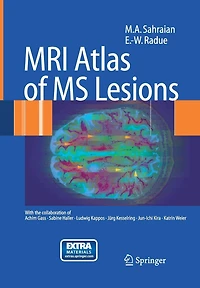 MRI Atlas of MS Lesions