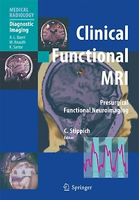 Clinical Functional MRI: Presurgical Neuroimaging