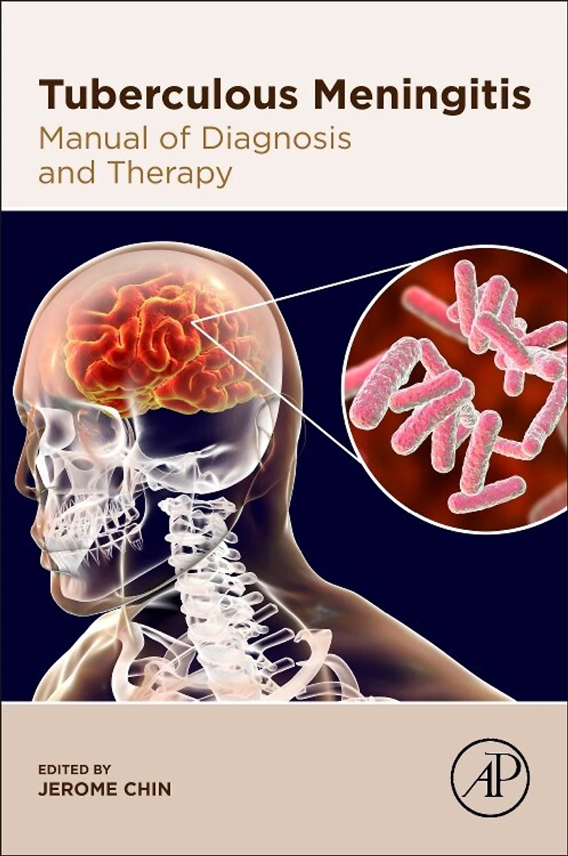 Tuberculous Meningitis: Manual Of Diagnosis And Therapy