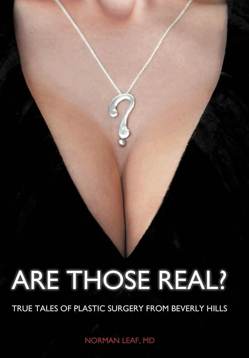 Are Those Real?: True Tales of Plastic Surgery from Beverly Hills