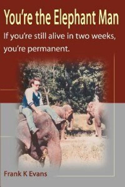 You're the Elephant Man: If You're Still Alive After Two Weeks, You're Permanent