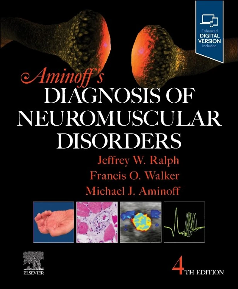 Aminoff's Diagnosis of Neuromuscular Disorders