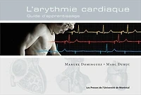 Arythmie cardiaque: guide d'apprentissage