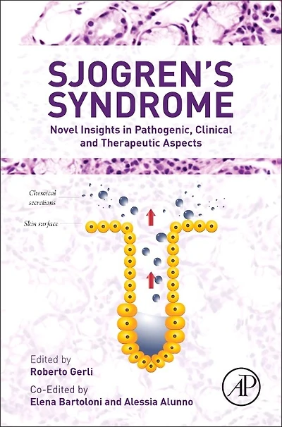 Sjogren's Syndrome: Novel Insights Pathogenic, Clinical And Therapeutic Aspects