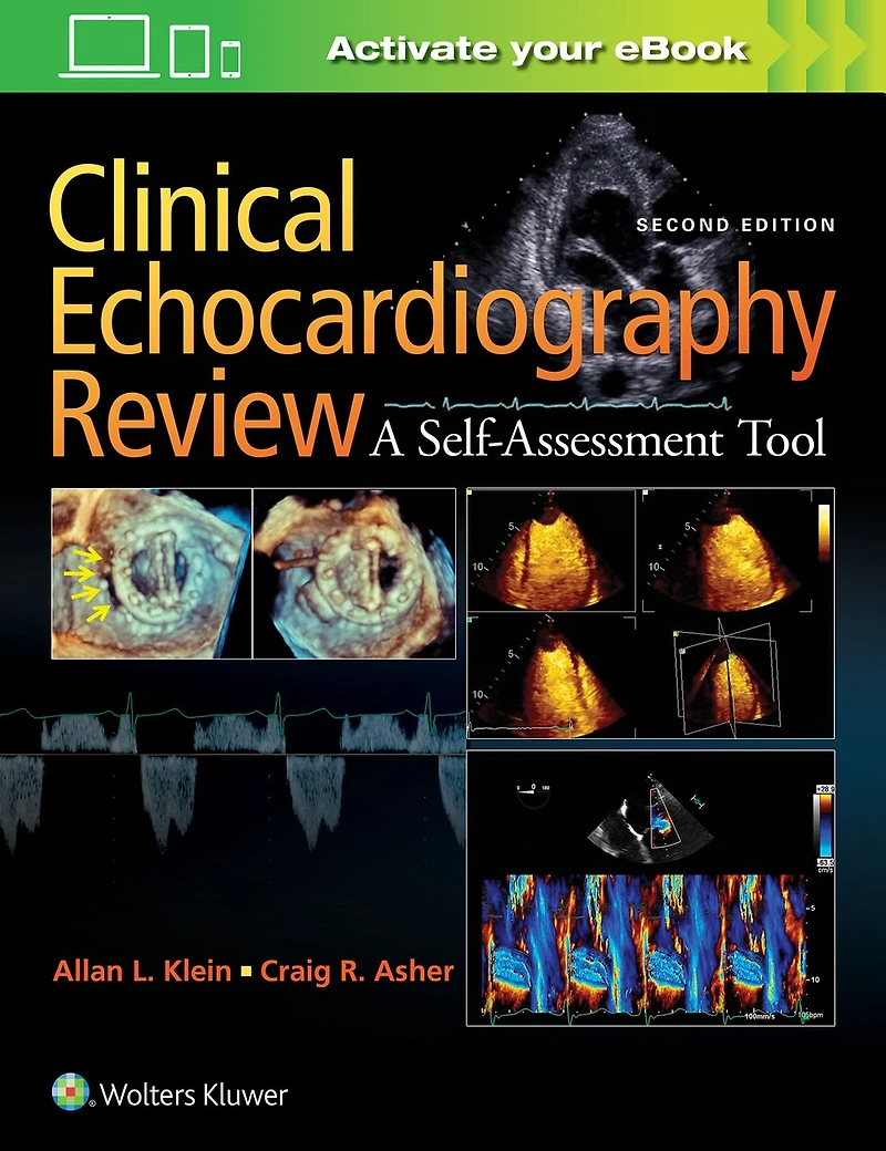 Clinical Echocardiography Review: A Self-Assessment Tool: Print + eBook with Multimedia