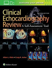 Clinical Echocardiography Review: A Self-Assessment Tool: Print + eBook with Multimedia