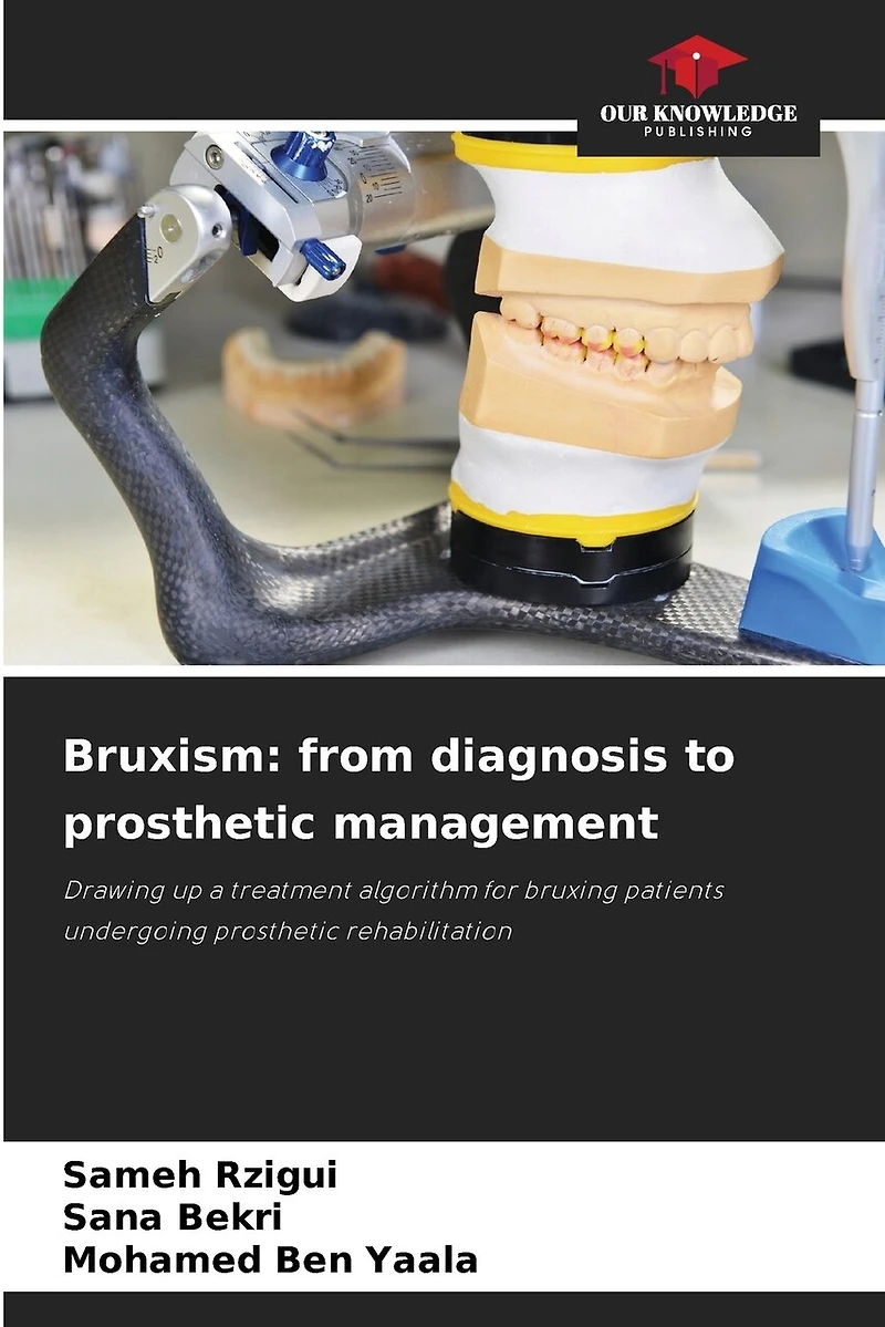 Bruxism: from diagnosis to prosthetic management