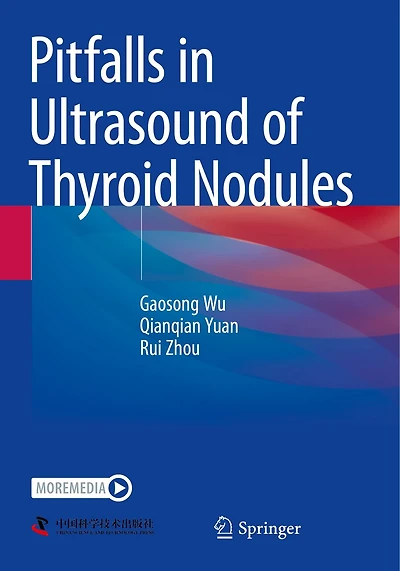 Pitfalls in Ultrasound of Thyroid Nodules