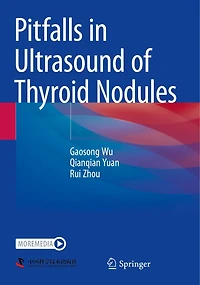 Pitfalls in Ultrasound of Thyroid Nodules