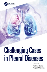 Challenging Cases Pleural Diseases
