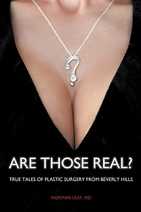 Are Those Real?: True Tales of Plastic Surgery from Beverly Hills