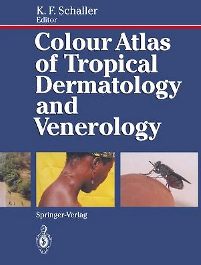 Colour Atlas of Tropical Dermatology and Venerology