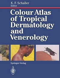 Colour Atlas of Tropical Dermatology and Venerology