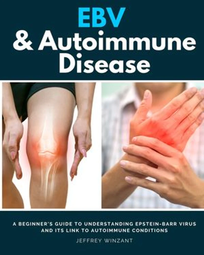 EBV & Autoimmune Disease: A Beginner's Guide to Understanding Epstein-Barr Virus and Its Link to Autoimmune Conditions
