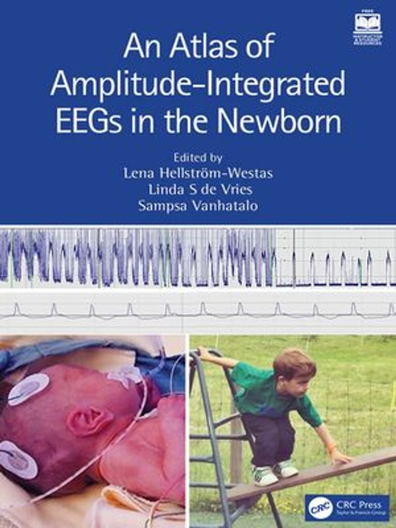 An Atlas of Amplitude-Integrated EEGs the Newborn