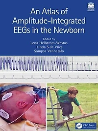 An Atlas of Amplitude-Integrated EEGs the Newborn