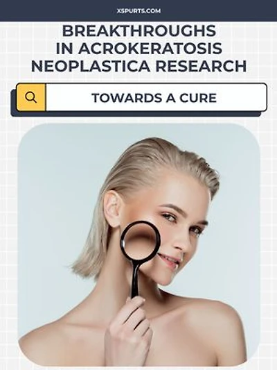 Breakthroughs in Acrokeratosis Neoplastica Research: Towards a Cure