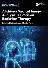 AI-driven Medical Image Analysis Precision Radiation Therapy