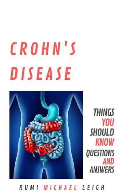 Crohn's Disease: Things You Should Know (Questions and Answers)