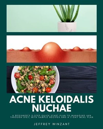 Acne Keloidalis Nuchae: A Beginner's 3-Step Quick Start Plan to Managing AKN Through Diet, With Sample Recipes and a 7-Day Meal Plan