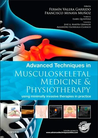 Advanced Techniques in Musculoskeletal Medicine & Physiotherapy - E-Book: Advanced Techniques in Musculoskeletal Medicine & Physiotherapy - E-Book