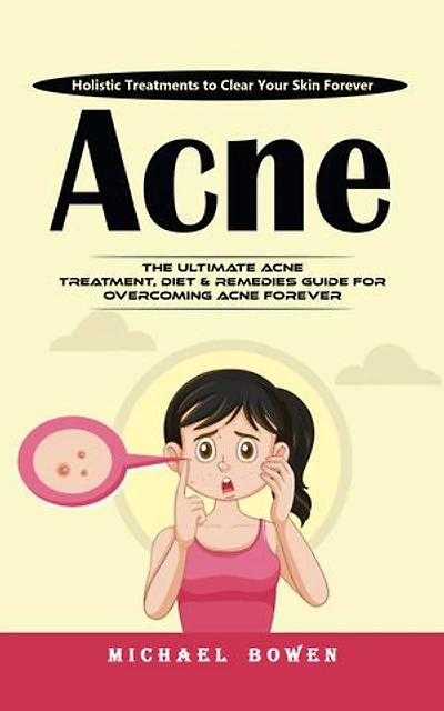 Acne: Holistic Treatments to Clear Your Skin Forever (The Ultimate Acne Treatment, Diet & Remedies Guide for Overcoming Acne Forever)