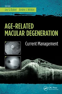 Age-Related Macular Degeneration: Current Management