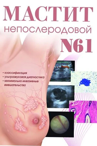 Мастит непослеродовой N61