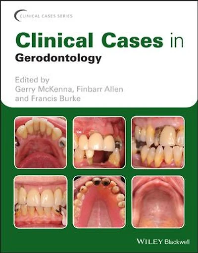 Clinical Cases Gerodontology