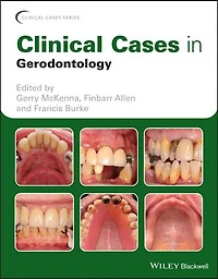 Clinical Cases Gerodontology