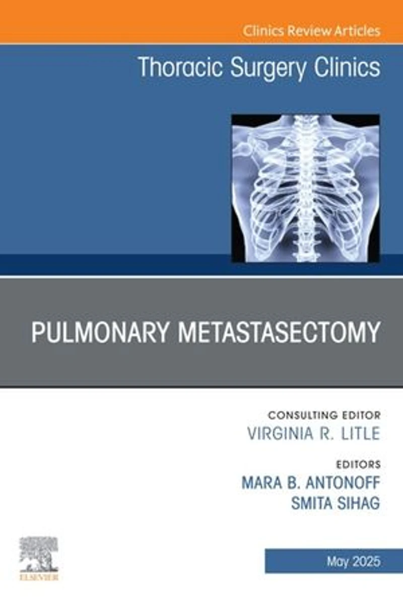 Pulmonary Metastasectomy, An Issue of Thoracic Surgery Clinics