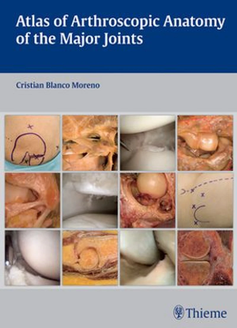 Atlas Of Arthroscopic Anatomy The Major Joints