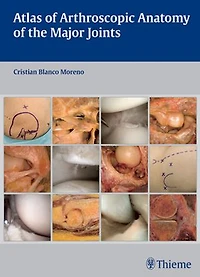 Atlas Of Arthroscopic Anatomy The Major Joints
