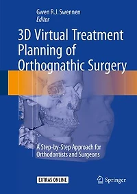 3D Virtual Treatment Planning of Orthognathic Surgery: A Step-by-Step Approach for Orthodontists and Surgeons