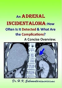An Adrenal Incidentaloma: How Often Is It Detected & What Are the Complications? A Concise Overview.