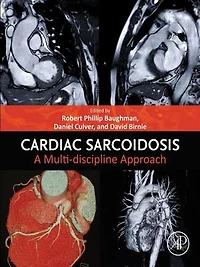 Cardiac Sarcoidosis: A Multi-discipline Approach