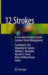 12 Strokes: A Case-based Guide To Acute Ischemic Stroke Management