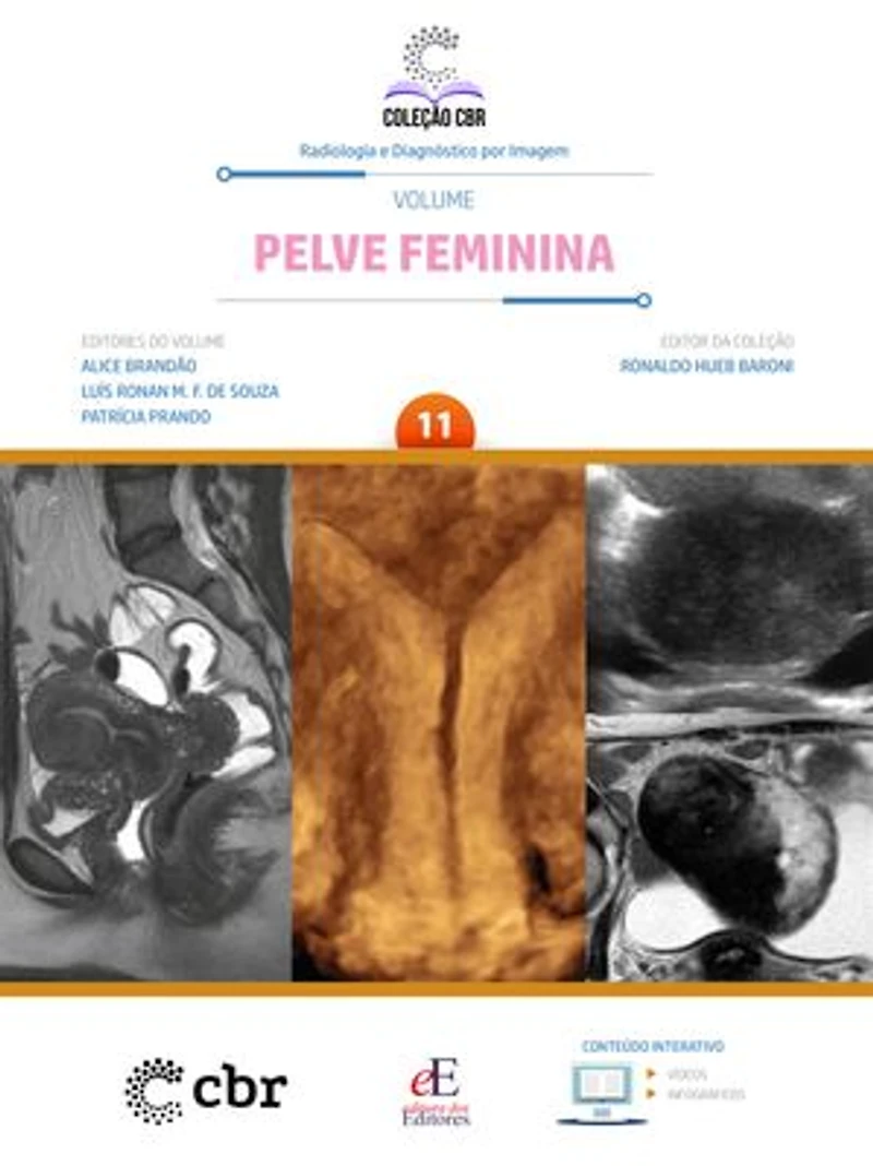Coleção CBR Volume 11 Pelve Feminina: Coleção CBR Radiologia e Diagnóstico por Imagem